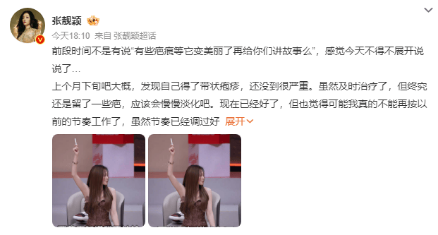 如何代理皇冠信用网
_张靓颖发长文谈身体状况如何代理皇冠信用网
,自曝得带状疱疹、旧伤复发,取消跨年演唱会加场计划