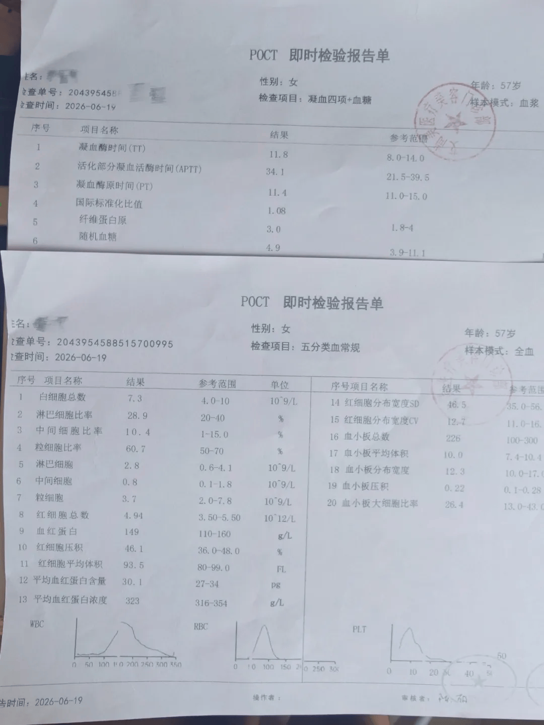 世界杯皇冠信用网代理_从600多元变成5万元世界杯皇冠信用网代理,广东57岁保洁员掏空积蓄做医美,双眼皮手术后眼睛红痛、视物模糊,当事人:销售像人贩子一样围着我;机构拒绝回应